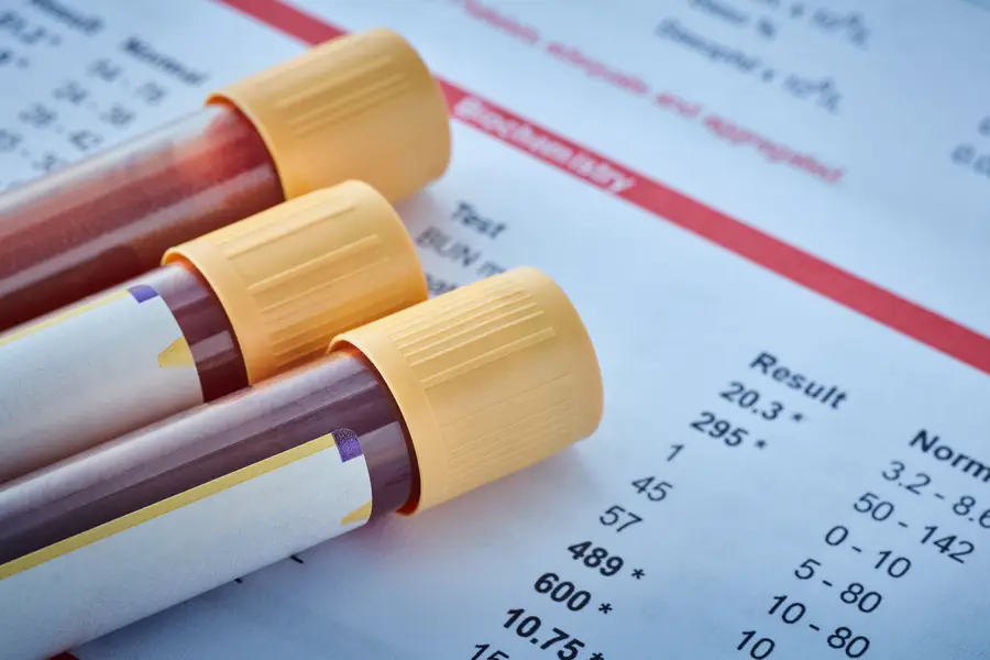 Que penser de l’analyse des IgG anti-aliments ?